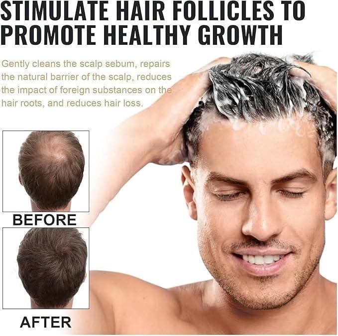 Root Activating Shampoo | For Voluminous Hair & Strong Roots